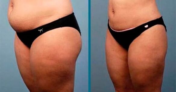 oyiga 10 kilogramm vazn yo'qotish usullari